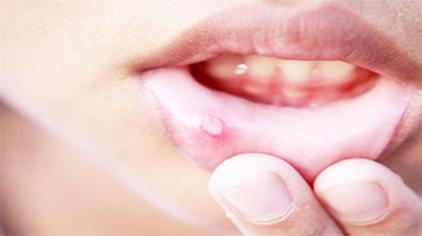 嘴唇起泡刮痧可以吗 西瓜视频