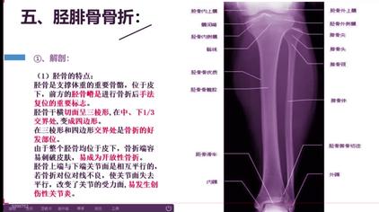 股骨及胫骨腓骨解剖图 西瓜视频